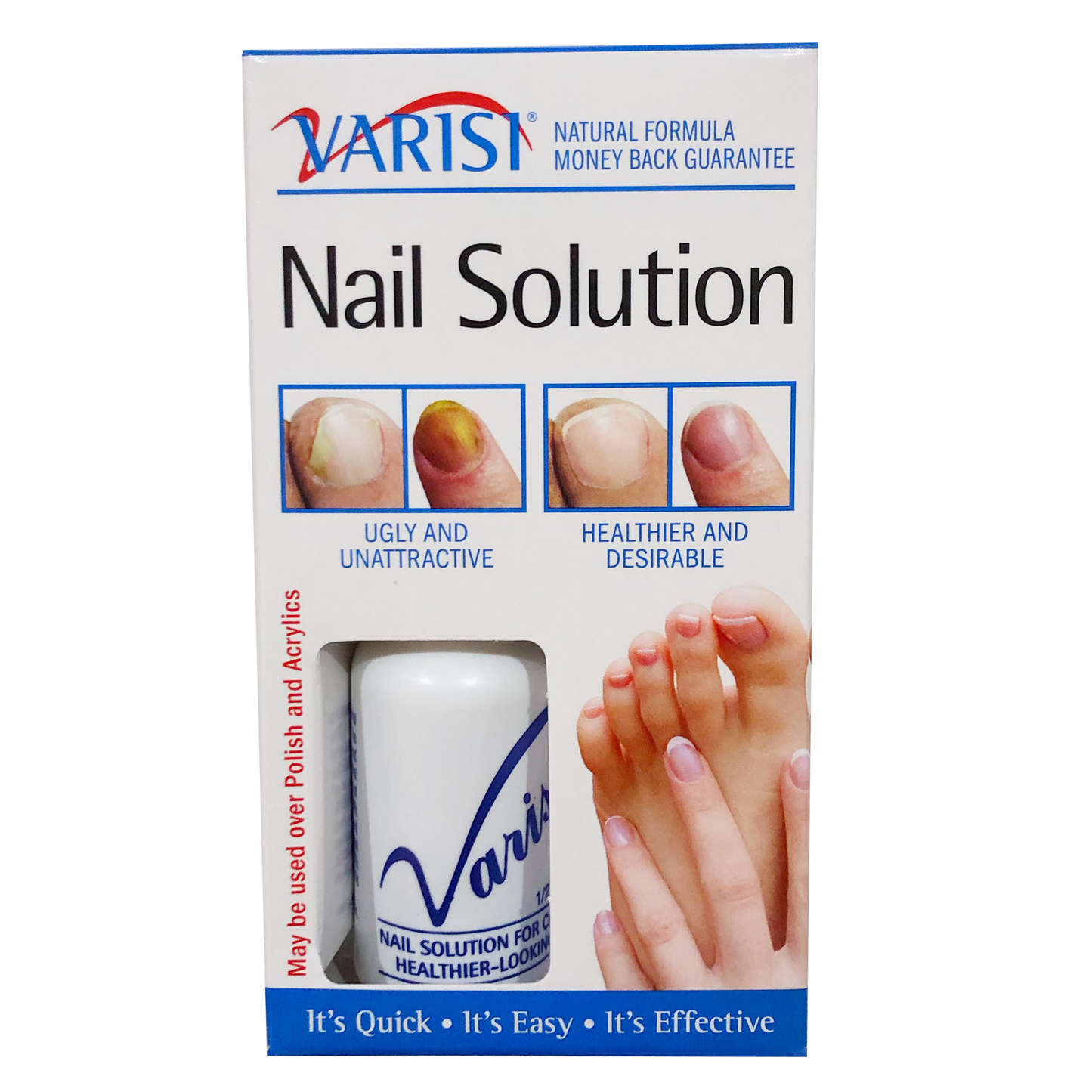 Varisi Chua thoi mong Varisi Nail Solution 1x15ml 10C